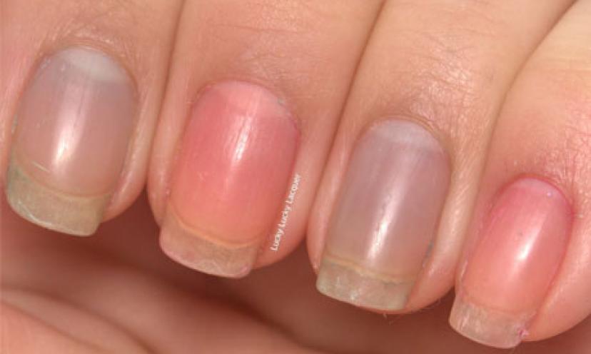 Remove Unwanted Stains From Fingernails in 4 Easy Steps!