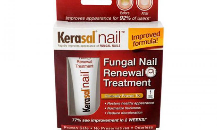 Get $2.00 Off Kerasal Nail Fungal Renewal Treatment!